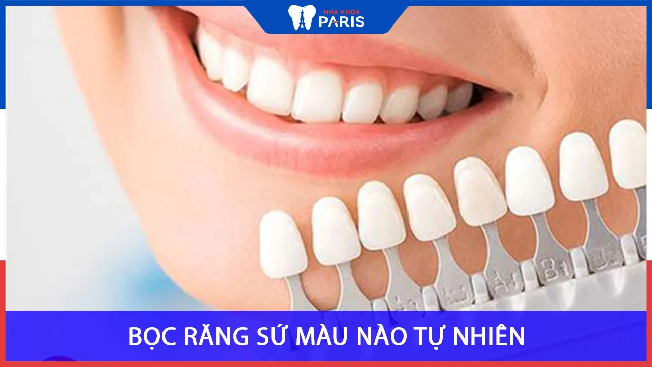 Có mấy Màu răng sứ? Bọc răng sứ màu nào Tự Nhiên