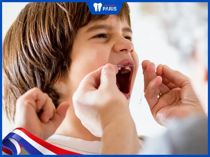 Cách nhổ răng bằng chỉ phổ biến? có an toàn không, có biến chứng không