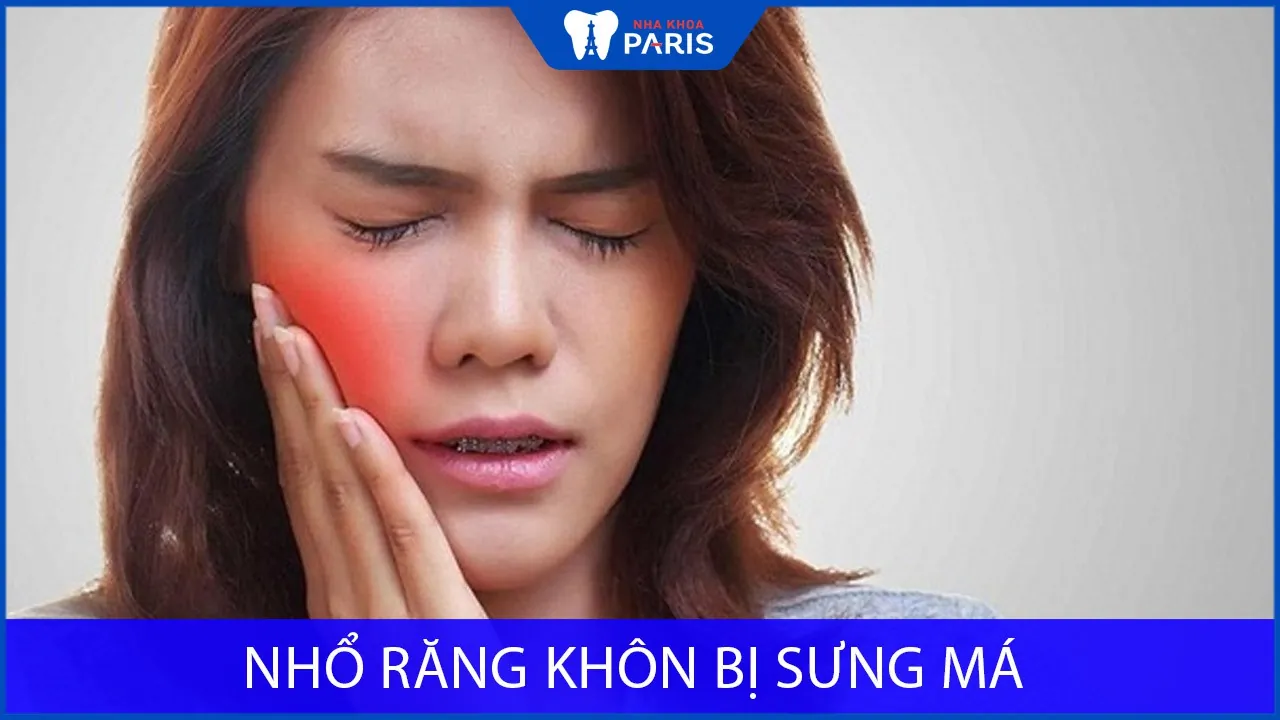 Nhổ răng khôn bị sưng má: Nguyên Nhân & Cách Xử Lý