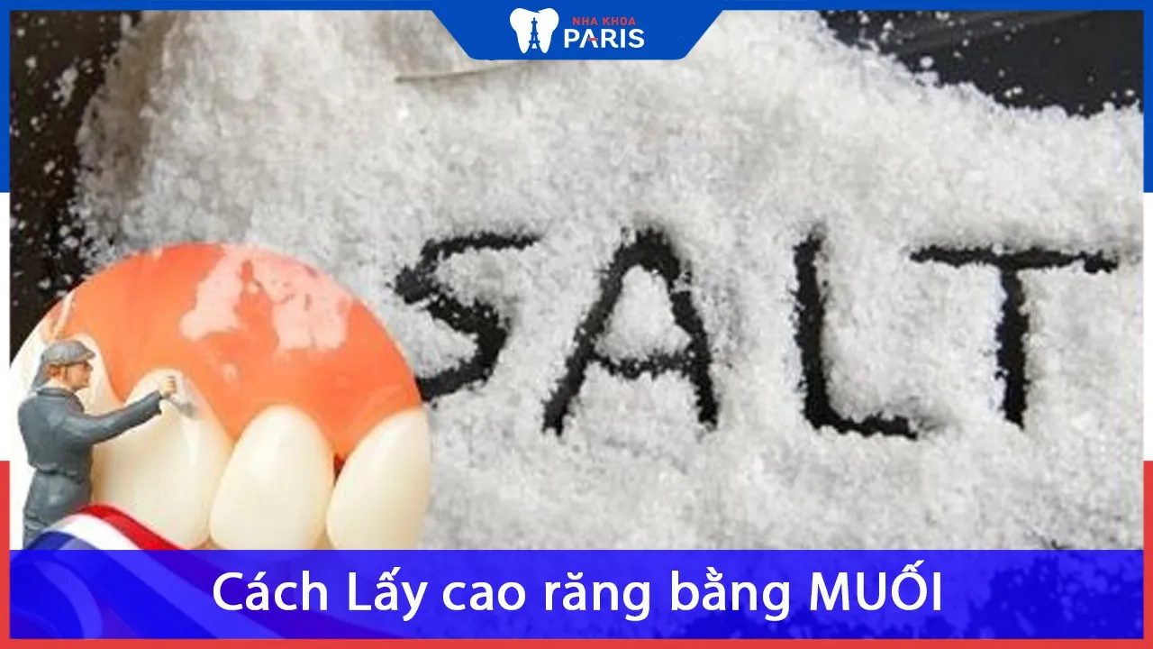 5 Cách Lấy cao răng bằng MUỐI chỉ 3 phút “sạch bay” vết bẩn