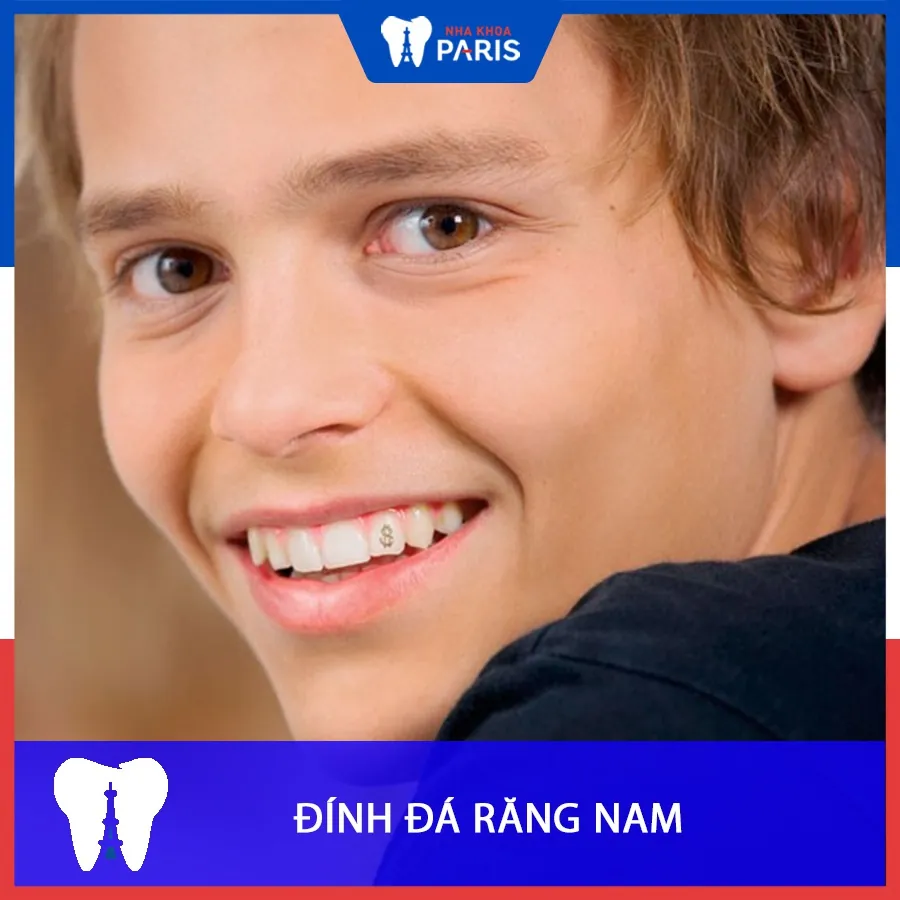 Đính đá răng nam xu hướng mới của các đấng mày râu