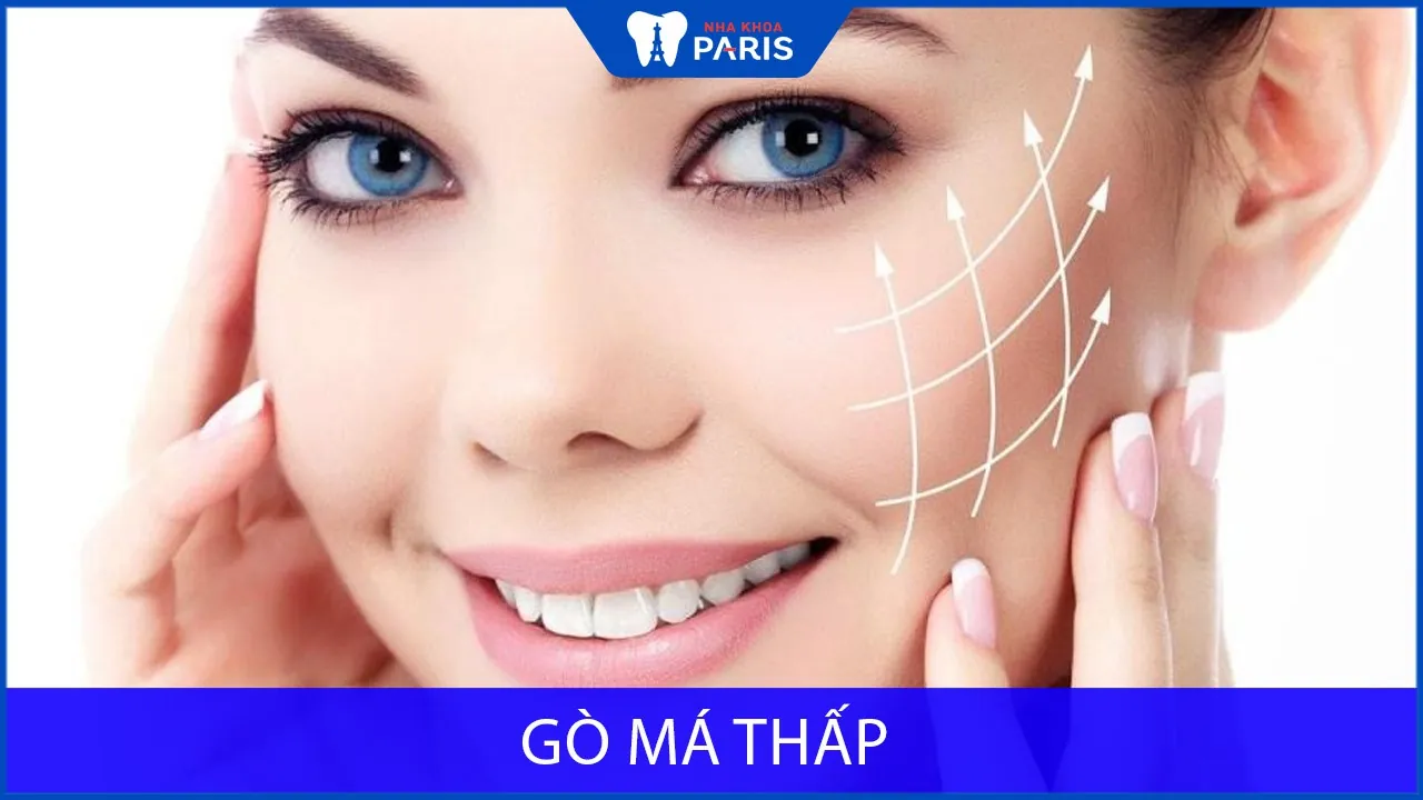 Gò má thấp là như thế nào? Nâng gò má giá bao nhiêu?