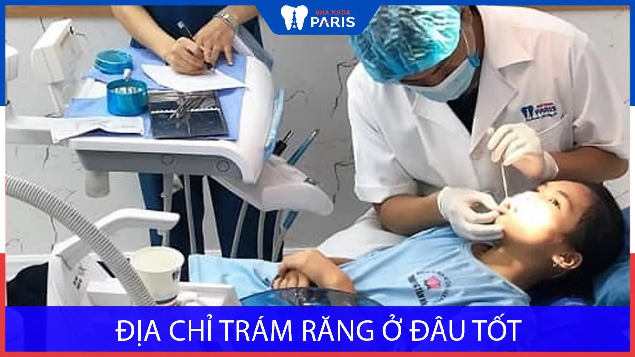 Địa chỉ trám răng ở đâu tốt, an toàn & chất lượng nhất toàn quốc