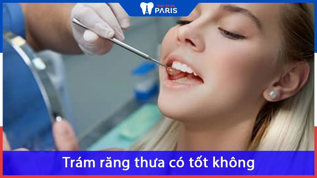 Trám răng thưa có tốt không? Có bền không? Hiệu quả ra sao