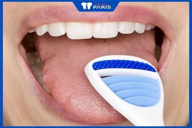 Có nên cạo lưỡi không – Những điều bạn cần biết