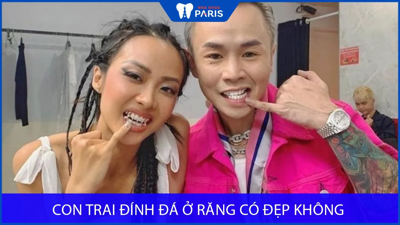 Con trai đính đá ở răng có đẹp không? Nha khoa Paris