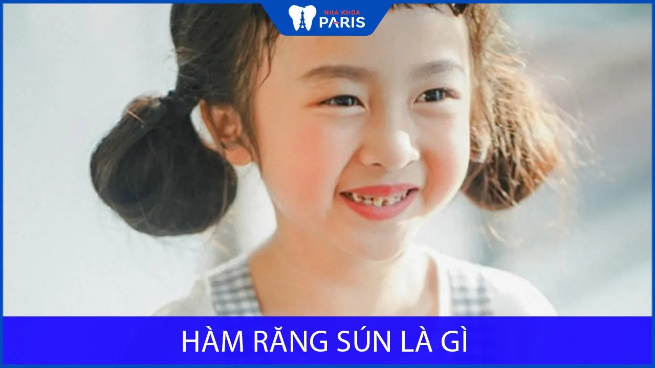 Hàm răng sún là gì? Những Cách trị sún răng cho trẻ