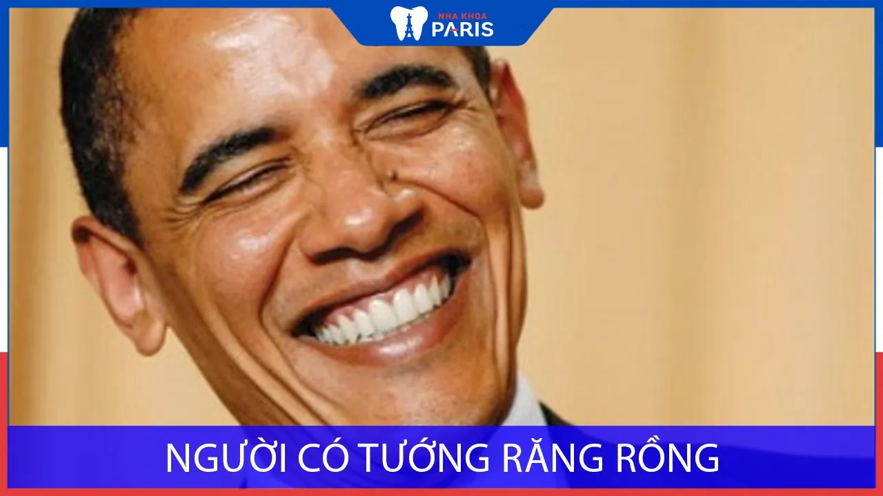 Người có tướng răng rồng là như nào | Tướng đại phú đại quý