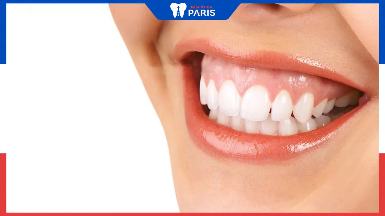 Phẫu thuật cười hở lợi có đau không? Hiện tượng đau xảy ra khi nào?