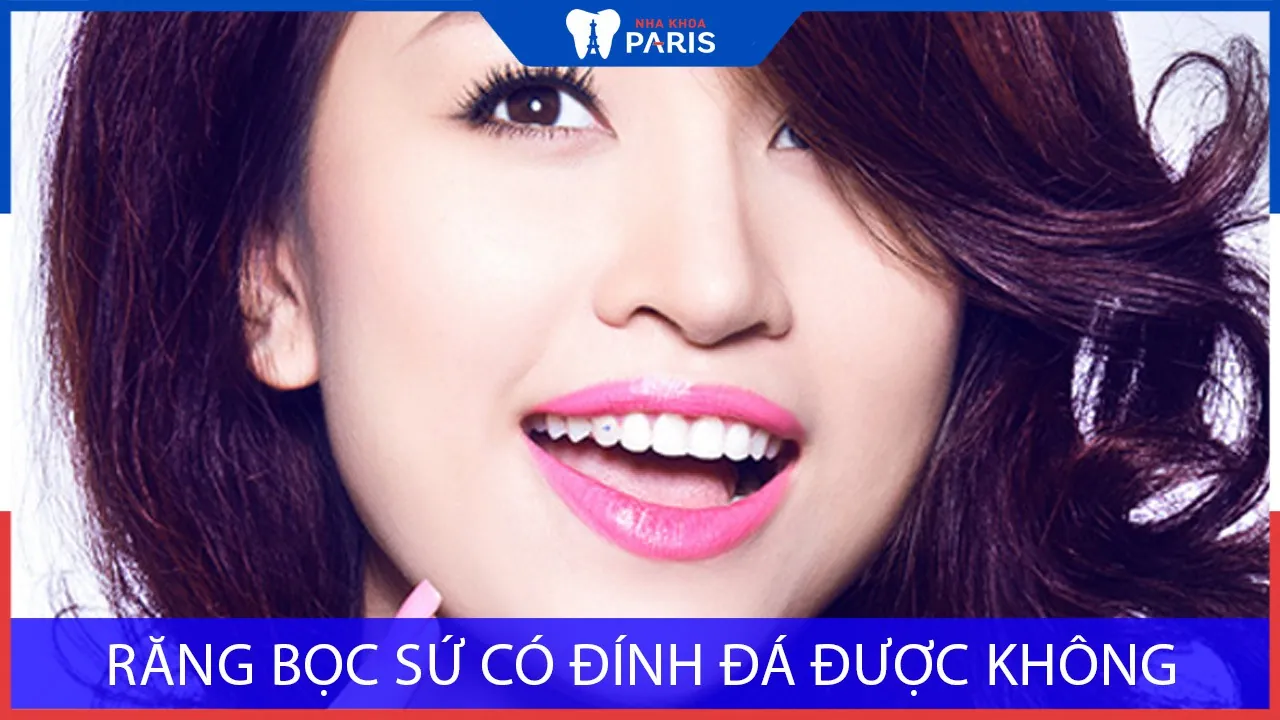 Răng bọc sứ có đính đá được không, có bền không?