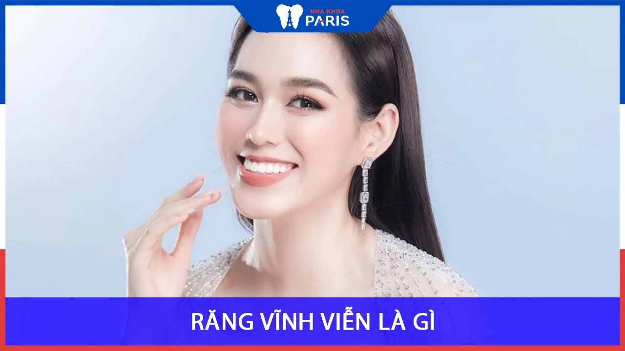Răng vĩnh viễn là gì? Bộ răng vĩnh viễn có bao nhiêu cái