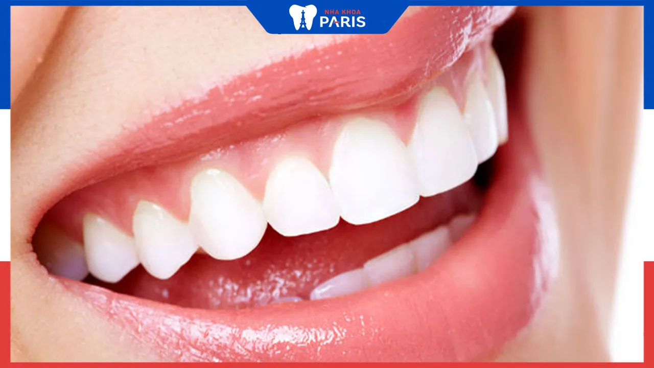 Bọc răng sứ có hết hô không? Nên điều trị như thế nào