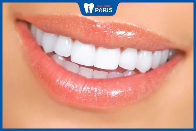 Bọc sứ 16 răng là gì? Lựa chọn răng sứ phù hợp để bọc sứ cho 16 răng