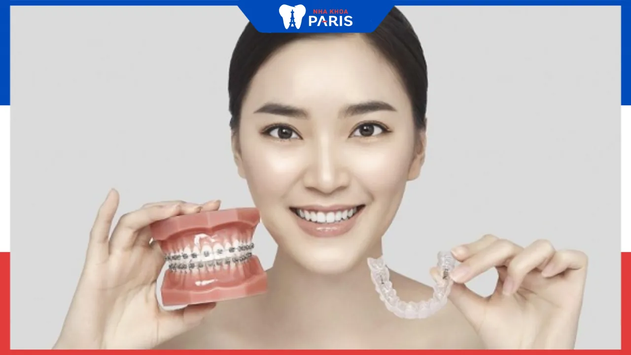 Niềng răng trong suốt không mắc cài và những điều cần biết