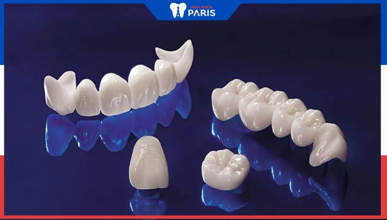 Chi phí để bọc 1 răng sứ là bao nhiêu – Nha khoa Paris