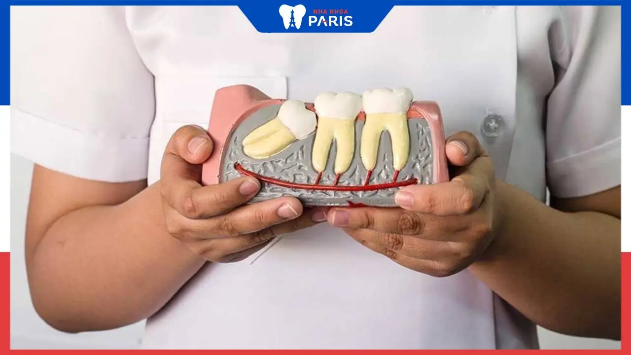 Nhổ răng khôn hết bao nhiêu tiền? Các yếu tố ảnh hưởng tới chi phí