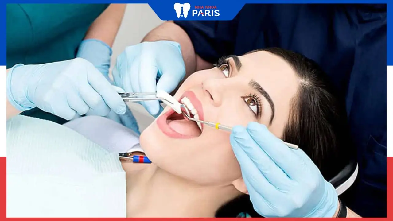 Trả lời câu hỏi: Nhổ răng khôn bao lâu thì hết đau