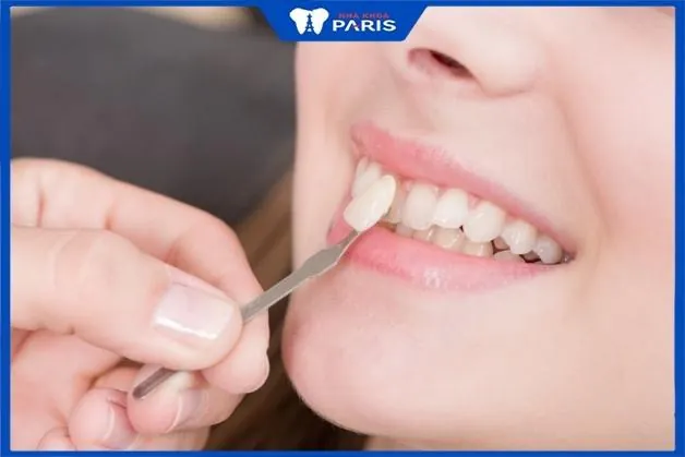 Mách bạn TOP 3 bác sĩ dán răng sứ giỏi ở Đà Nẵng nổi tiếng