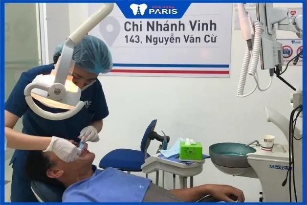 Địa chỉ trồng răng uy tín tại Vinh – 4 tiêu chí đánh giá