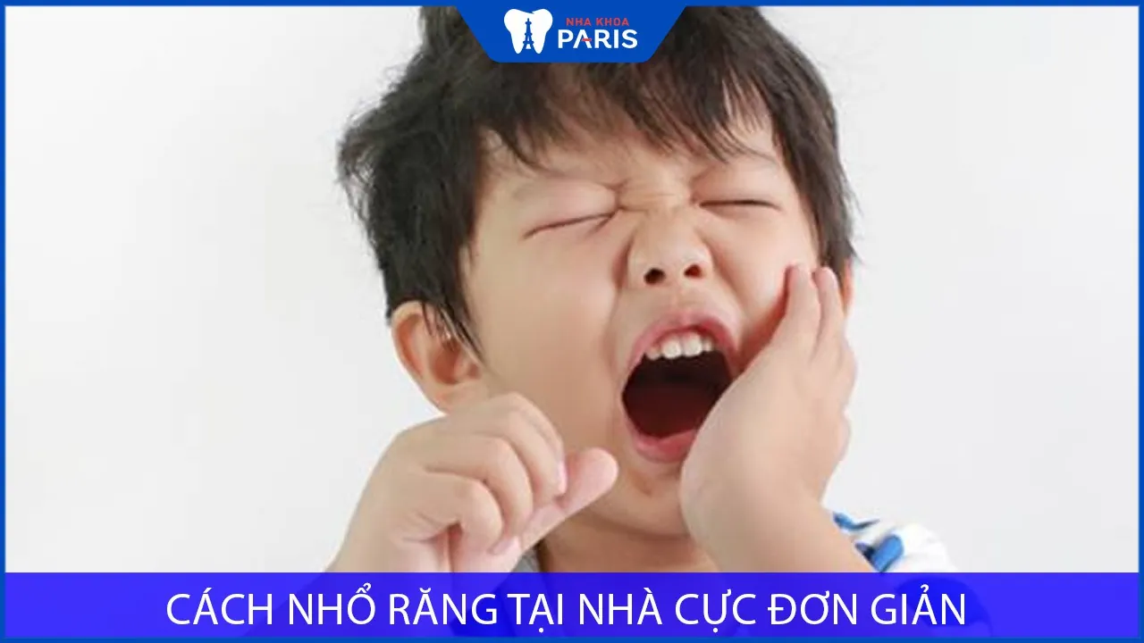 Bỏ túi các cách nhổ răng tại nhà cực đơn giản
