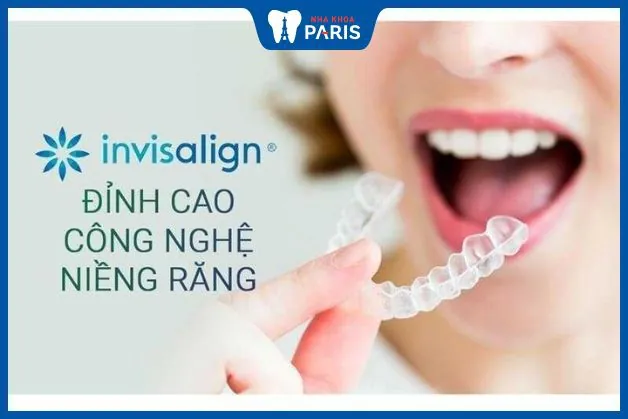 Công nghệ niềng răng Invisalign: Ưu nhược điểm + Chi phí