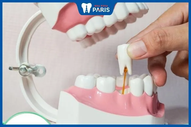 Góc giải đáp: Trẻ 15 tuổi nhổ răng hàm có mọc lại không