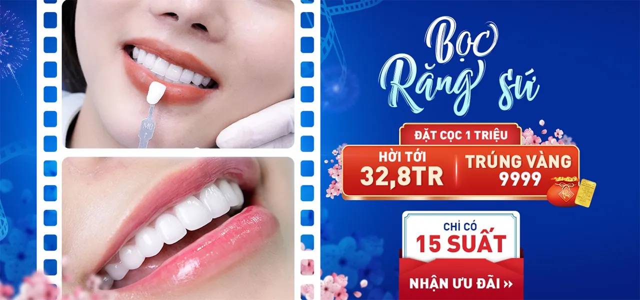Đặt cọc bọc răng sứ giá tốt nhất năm