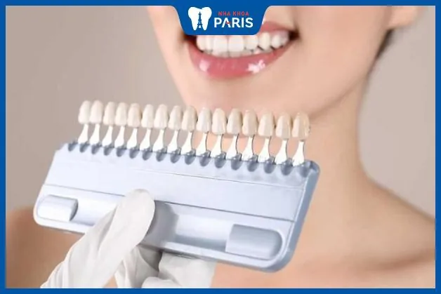 Lựa chọn bảng màu răng sứ titan –  4 tips lựa chọn màu răng phù hợp