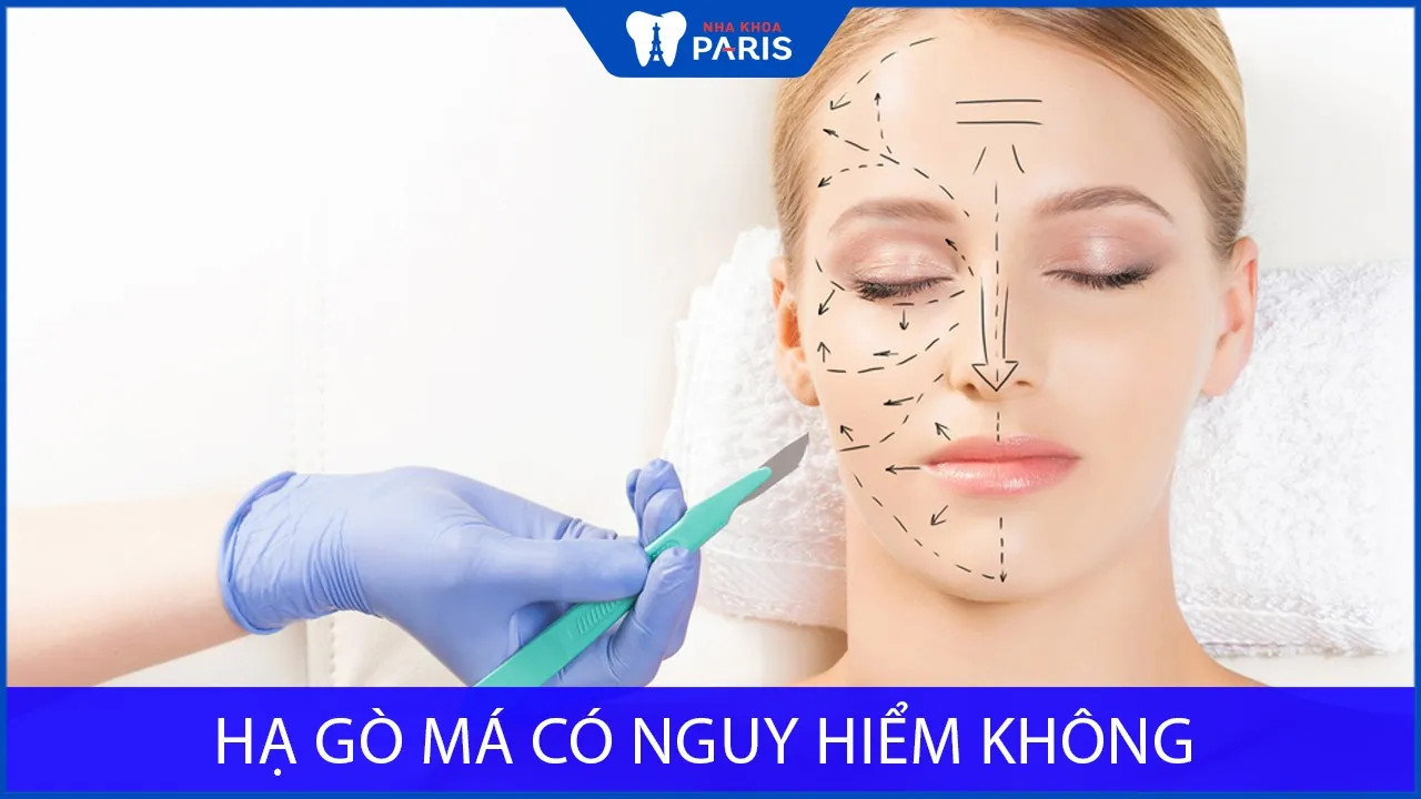 Hạ gò má có nguy hiểm không? Lưu ý trước khi phẫu thuật
