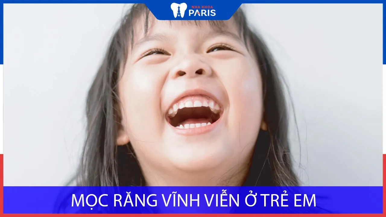 Mọc răng vĩnh viễn ở trẻ em: Lịch trình và những điều cần lưu ý