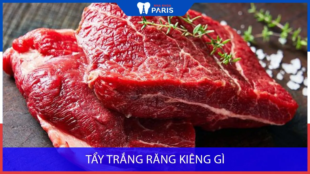 Thực phẩm nên và không nên ăn khi đang tẩy trắng răng