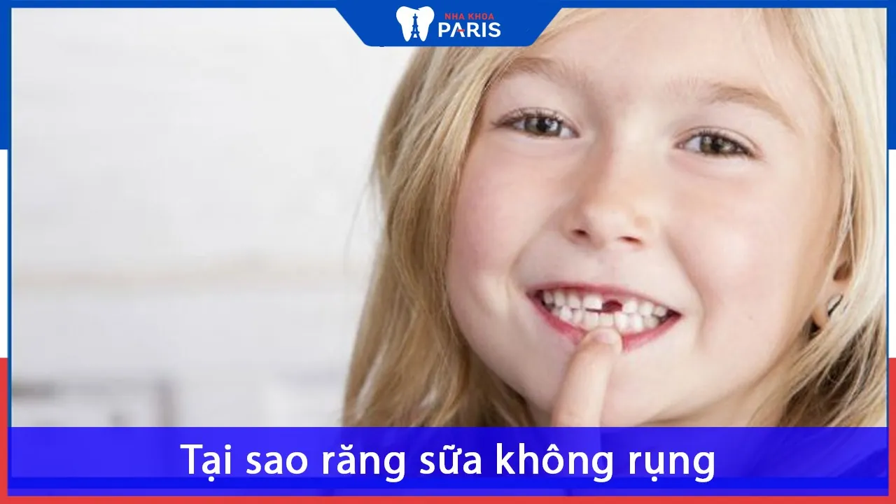 Tại sao răng sữa không rụng? Vấn đề và cách giải quyết