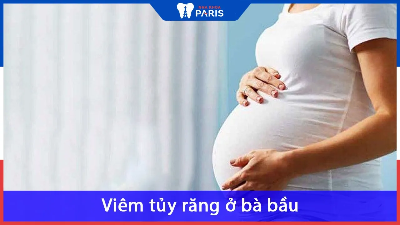 Viêm tủy răng ở bà bầu: Nguyên Nhân, Dấu Hiệu & Cách Điều Trị