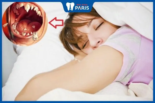 Giấc mơ rụng răng – Hiểu rõ ý nghĩa và những bí ẩn đằng sau