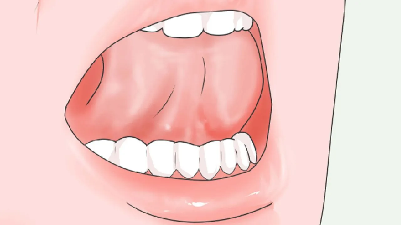 Tập Mewing sai cách: Nguy cơ tiềm ẩn bạn cần chú ý