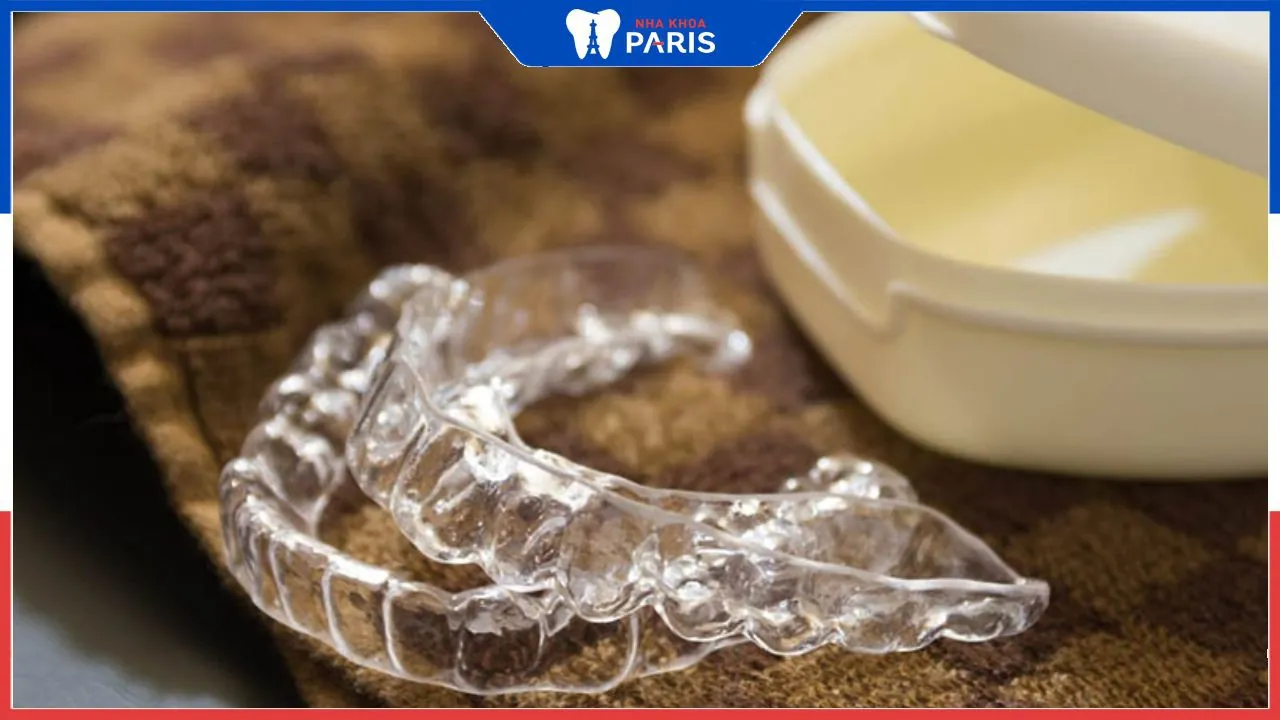 Máng nhai: Tác dụng, phân loại và hướng dẫn cách dùng