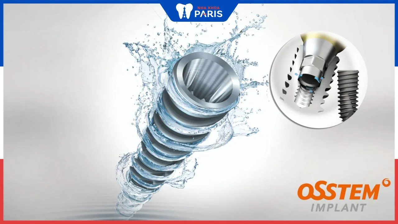 Trụ Implant Osstem: Xuất xứ, cấu tạo và ưu, nhược điểm