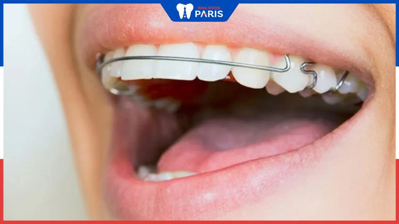 Các loại hàm duy trì hiện nay – Ưu nhược điểm của từng loại