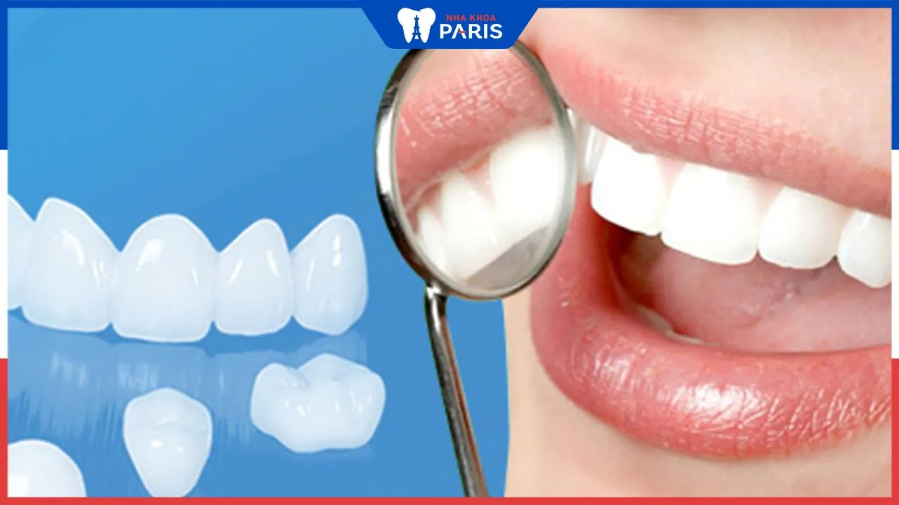 Hướng dẫn: Cách dán răng giả bị rớt chuẩn nha khoa
