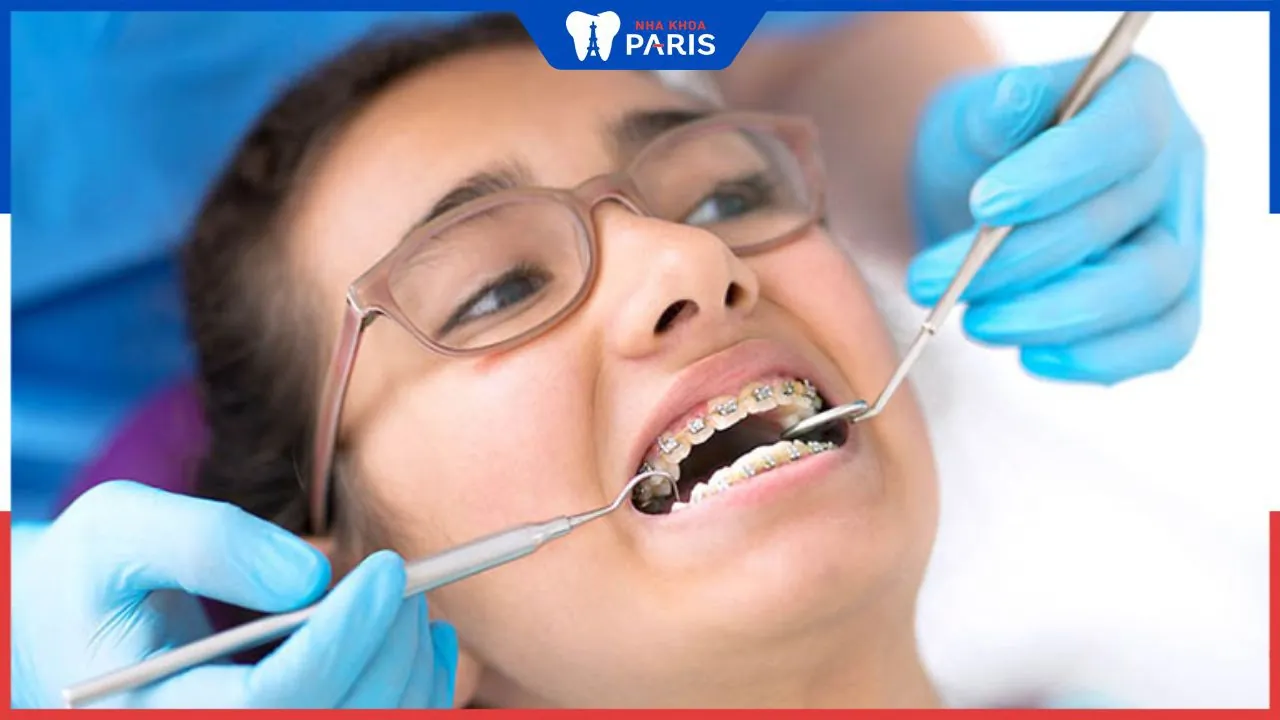 Top 10 địa chỉ nha khoa niềng răng uy tín nhất