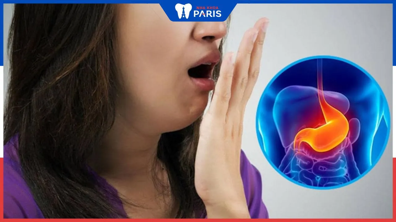 Trị hôi miệng từ dạ dày: Phương pháp chữa trị tận gốc