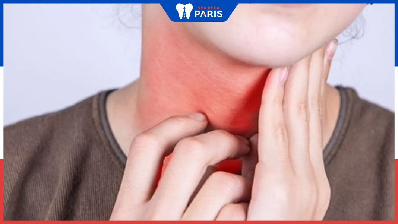 Tổng hợp các biện pháp chữa viêm họng hạt triệt để