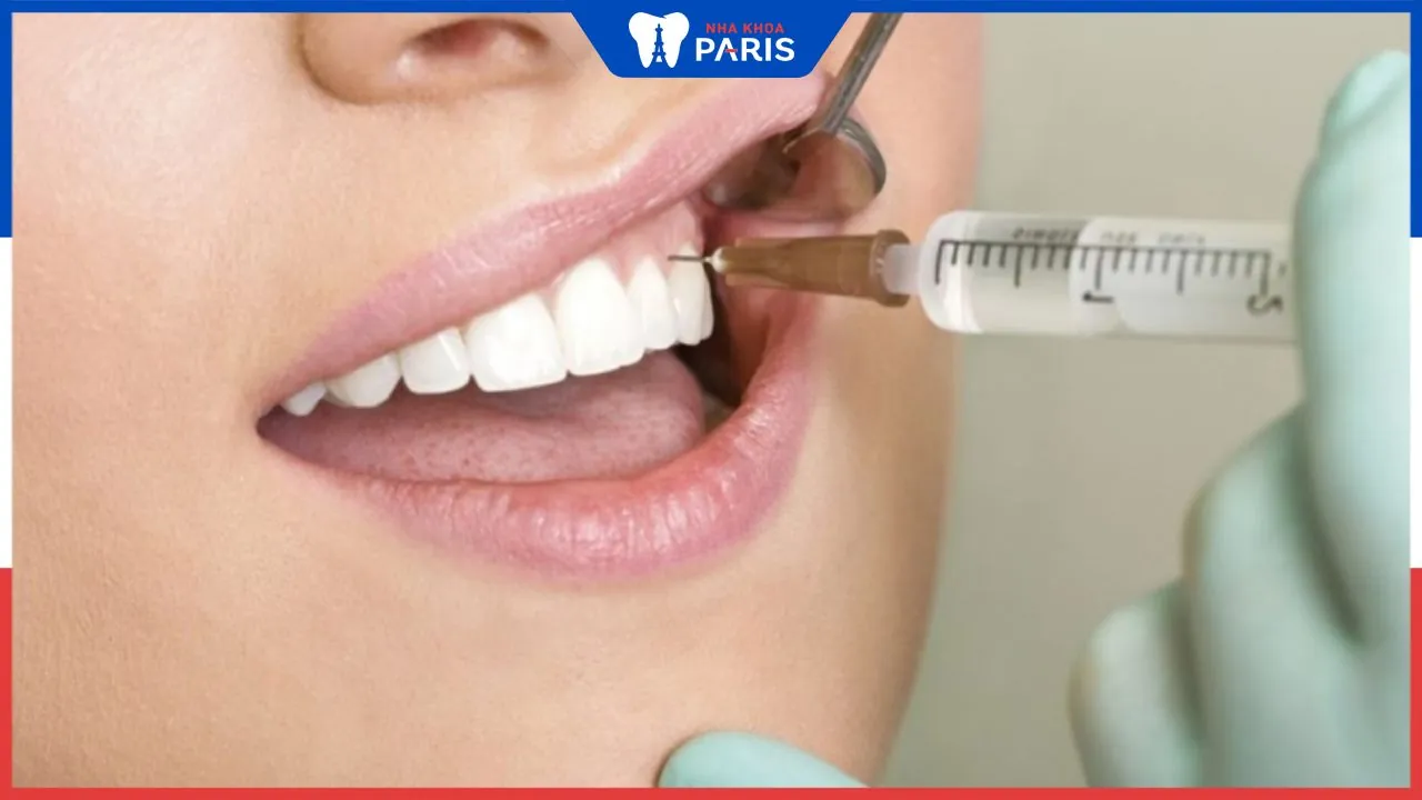 Tiêm thuốc tê nhổ răng có đau không? Lưu ý sau khi tiêm thuốc tê