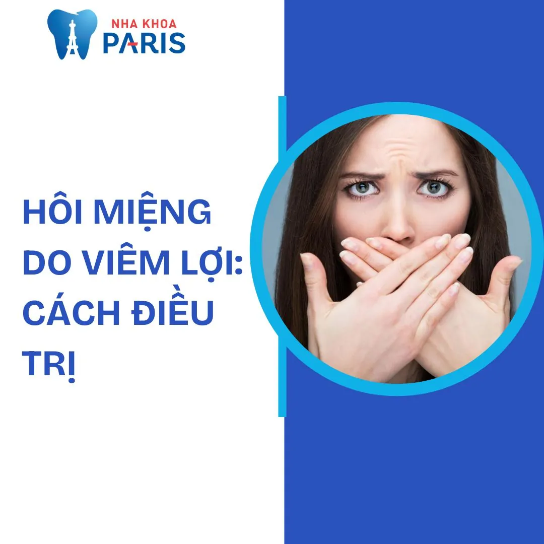 Hôi miệng do viêm lợi: Nguyên nhân và cách điều trị hiệu quả