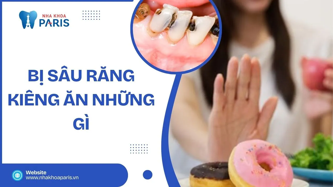 Bị sâu răng kiêng ăn những gì? Lưu ý khi chăm sóc tại nhà