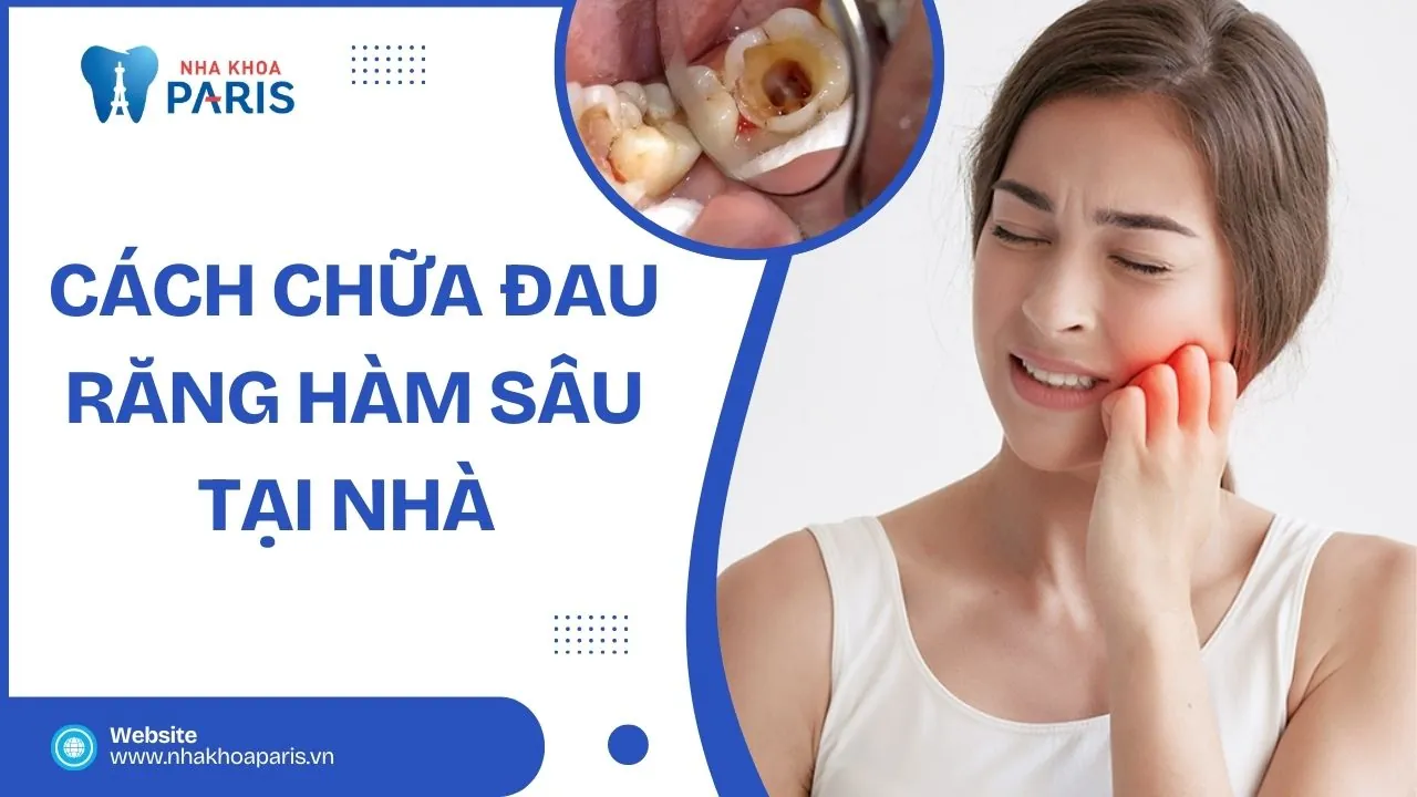 Cách chữa đau răng hàm sâu tại nhà hiệu quả và dễ thực hiện