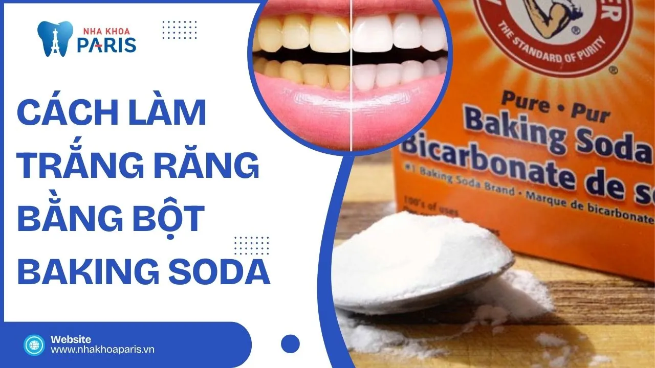 Bỏ túi 12 cách làm trắng răng bằng baking soda hiệu quả nhất