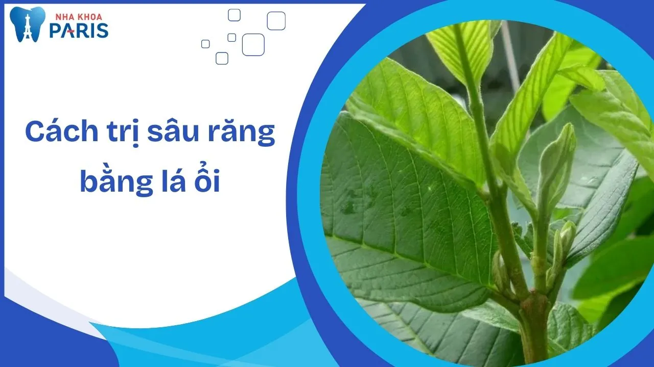 4 cách trị sâu răng bằng lá ổi: Hiệu quả tức thời trong 5 phút
