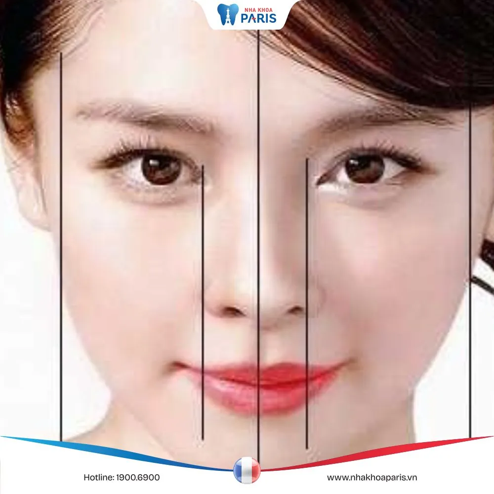 Cách xác định mặt lệch bên nào? Khắc phục tình trạng mặt lệch