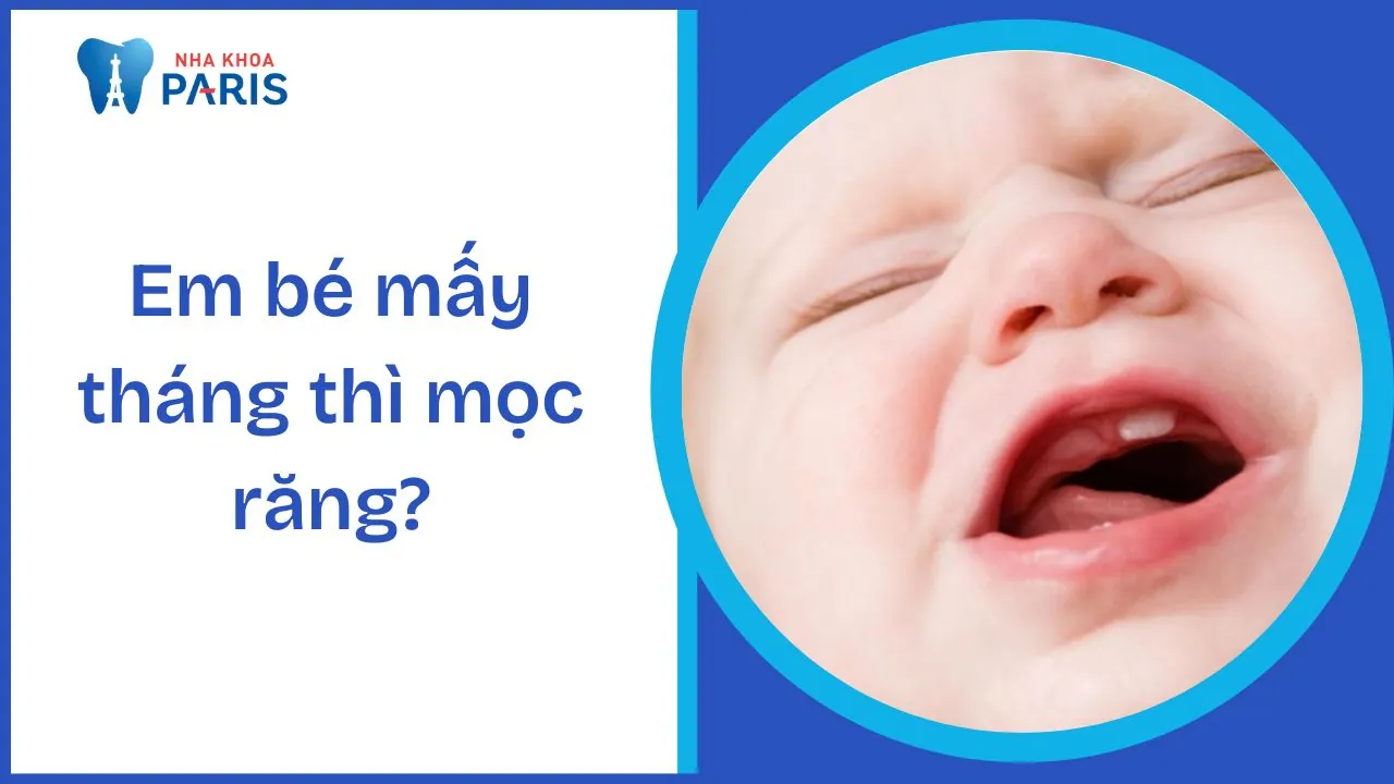 Em bé mấy tháng thì mọc răng? Dấu hiệu và cách chăm sóc